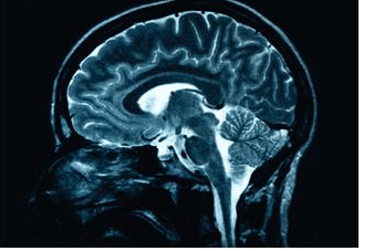 BC injury law brain mri image